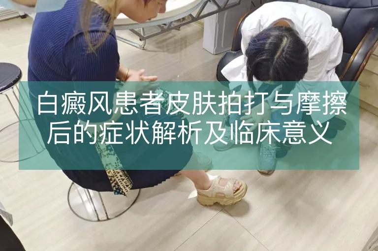 白癜风患者皮肤拍打与摩擦后的症状解析及临床意义