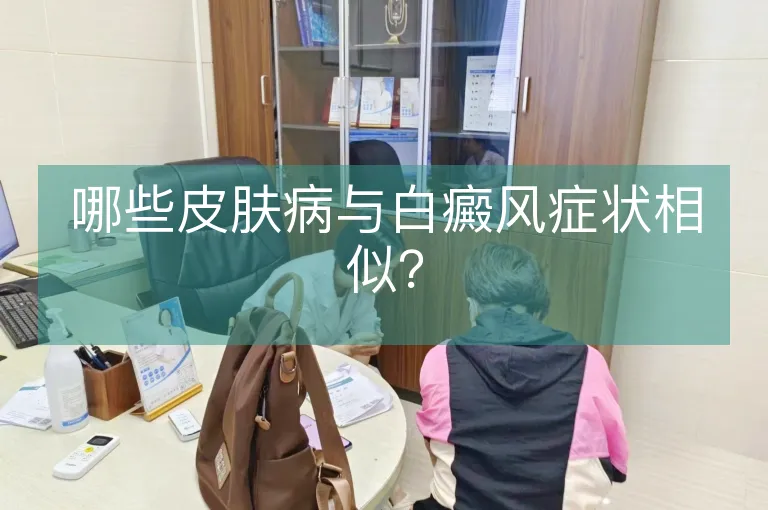 哪些皮肤病与白癜风症状相似？