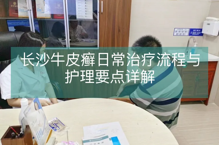 长沙牛皮癣日常治疗流程与护理要点详解