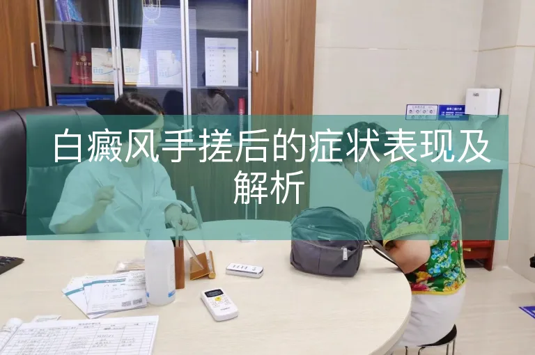白癜风手搓后的症状表现及解析