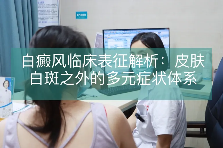 白癜风临床表征解析：皮肤白斑之外的多元症状体系