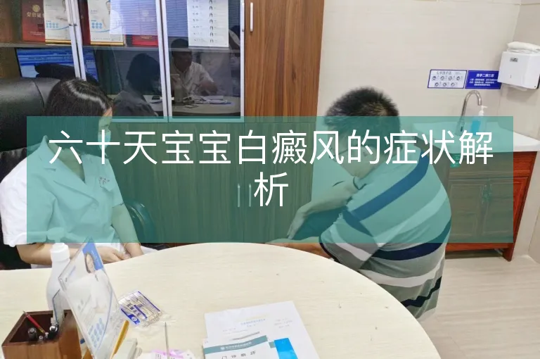 六十天宝宝白癜风的症状解析