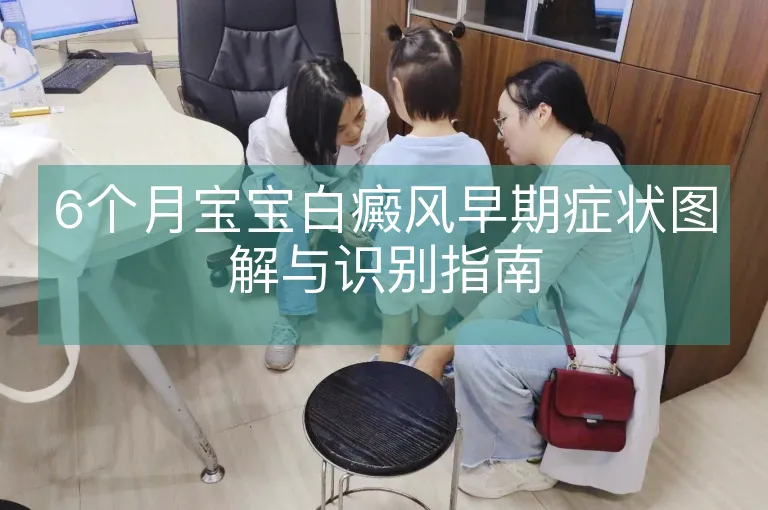 6个月宝宝白癜风早期症状图解与识别指南