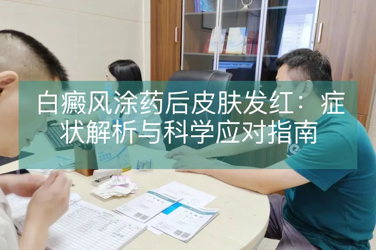 白癜风涂药后皮肤发红：症状解析与科学应对指南