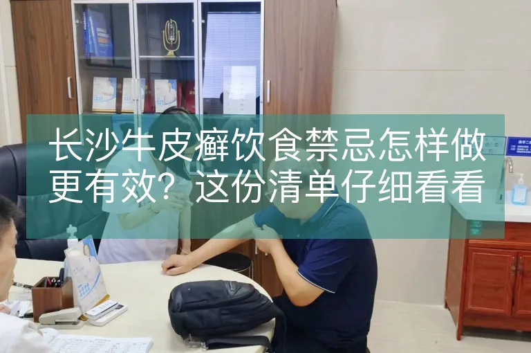 长沙牛皮癣饮食禁忌怎样做更有效？这份清单仔细看看
