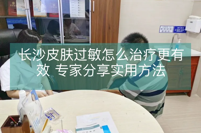 长沙皮肤过敏怎么治疗更有效 专家分享实用方法