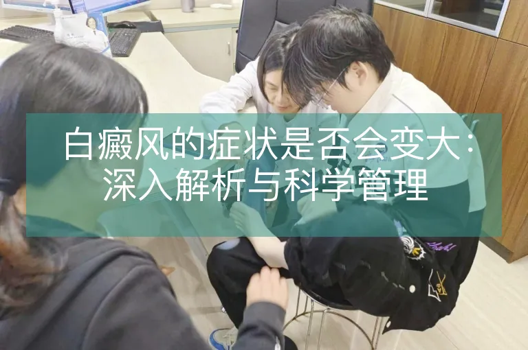 白癜风的症状是否会变大：深入解析与科学管理