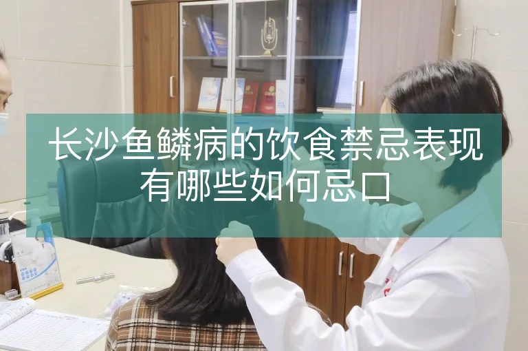 长沙鱼鳞病的饮食禁忌表现有哪些如何忌口