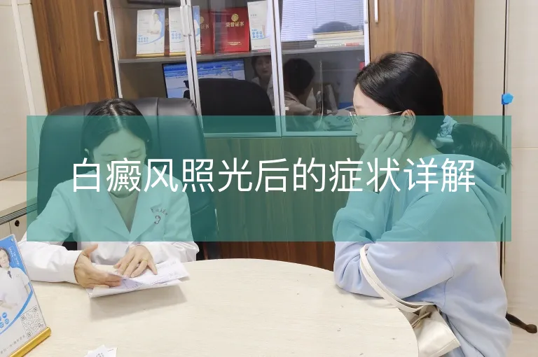 白癜风照光后的症状详解