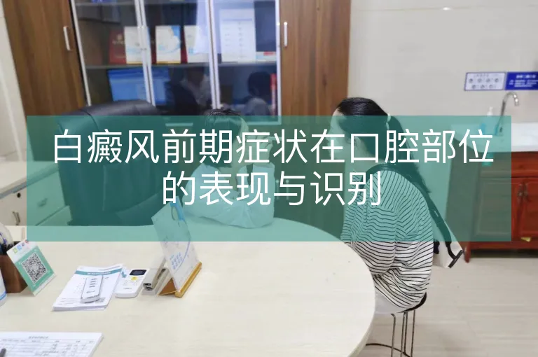 白癜风前期症状在口腔部位的表现与识别