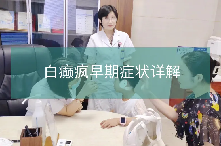 白癫疯早期症状详解
