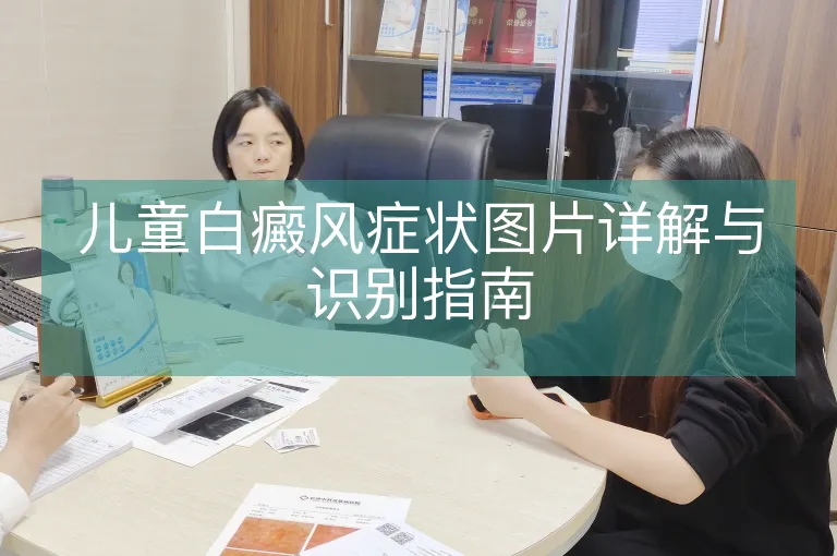 儿童白癜风症状图片详解与识别指南