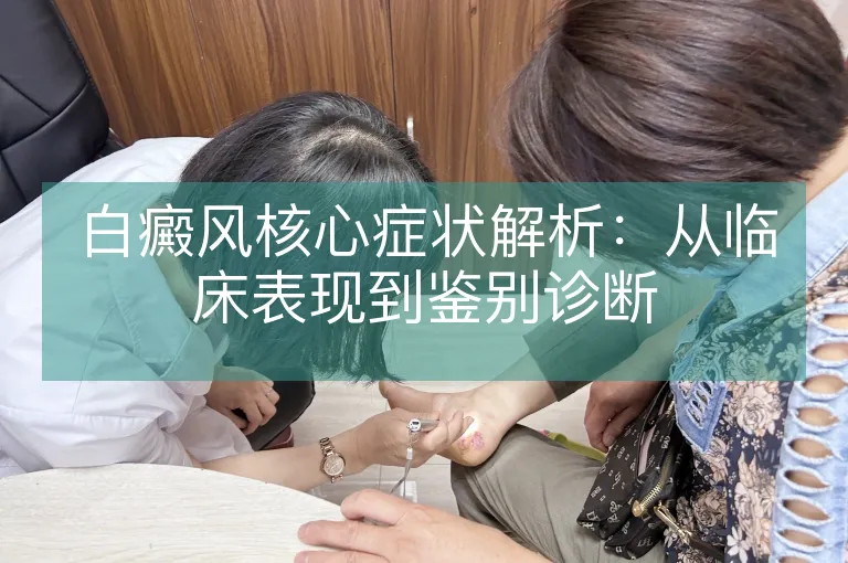 白癜风核心症状解析：从临床表现到鉴别诊断