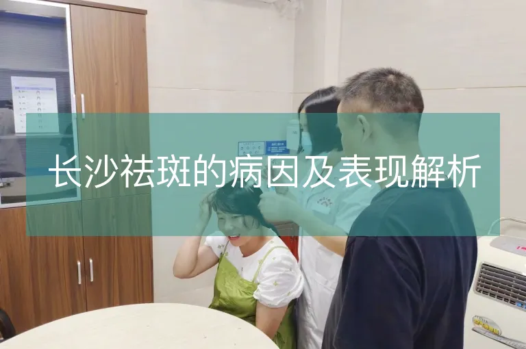长沙祛斑的病因及表现解析