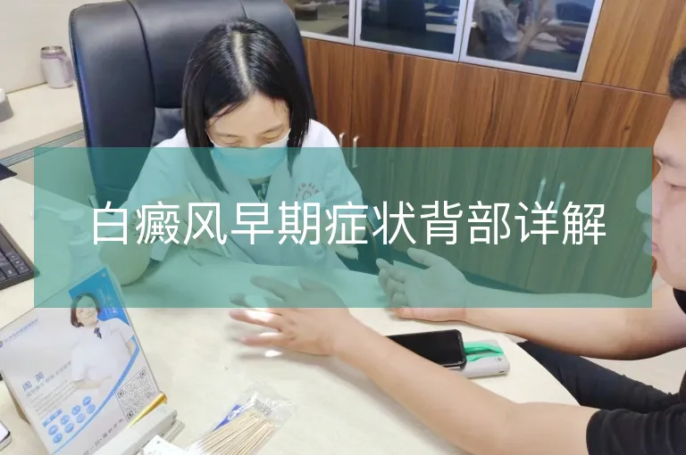 白癜风早期症状背部详解