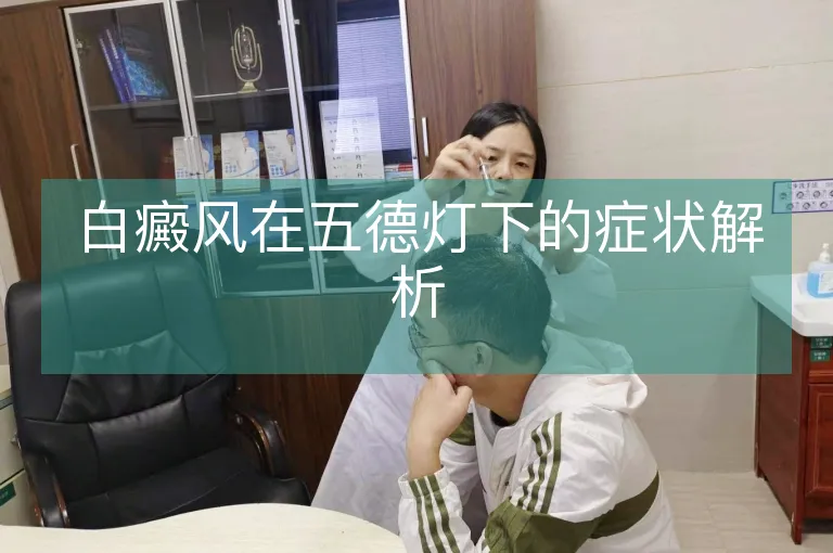 白癜风在五德灯下的症状解析