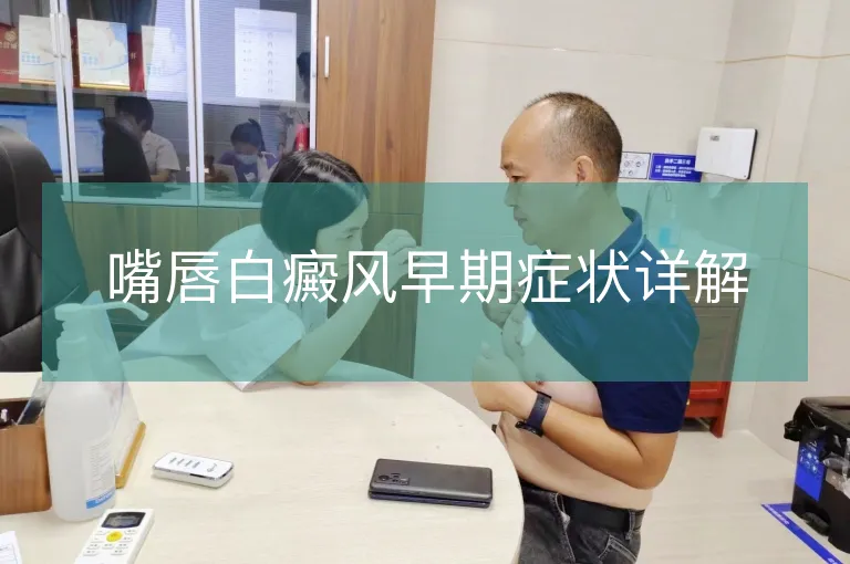 嘴唇白癜风早期症状详解