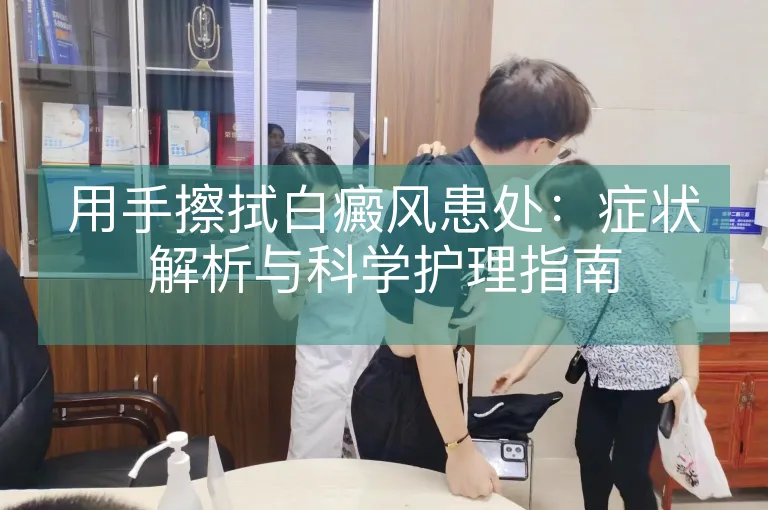 用手擦拭白癜风患处：症状解析与科学护理指南