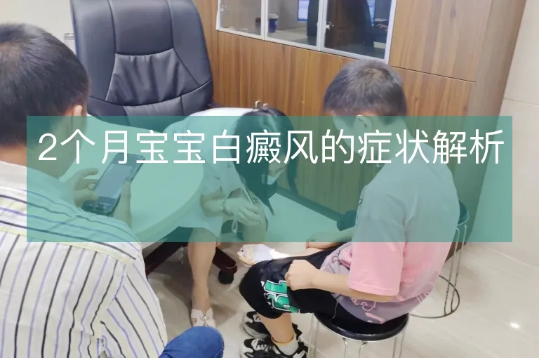 2个月宝宝白癜风的症状解析