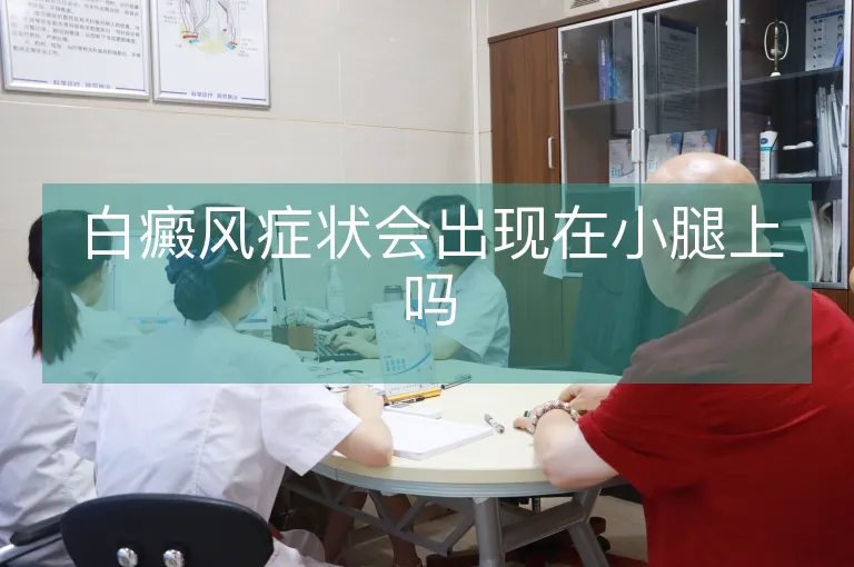 白癜风症状会出现在小腿上吗