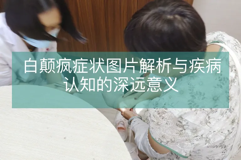 白颠疯症状图片解析与疾病认知的深远意义